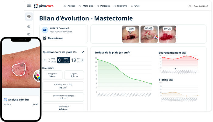 Visuel de l'interface Pixacare
